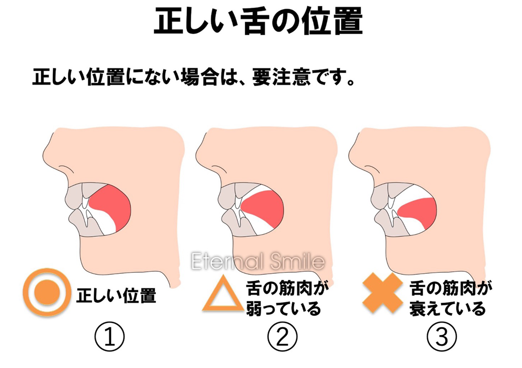 二 重 あご 舌 の 位置